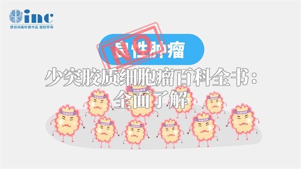 少突胶质细胞瘤百科全书：全面了解