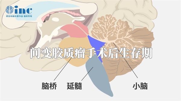 间变胶质瘤手术后生存期