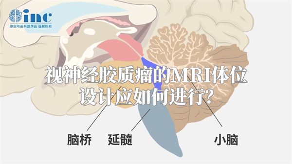 视神经胶质瘤的MRI体位设计应如何进行？