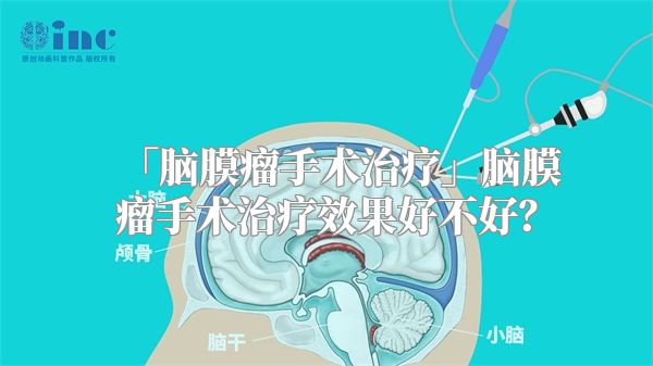 「脑膜瘤手术治疗」脑膜瘤手术治疗效果好不好？