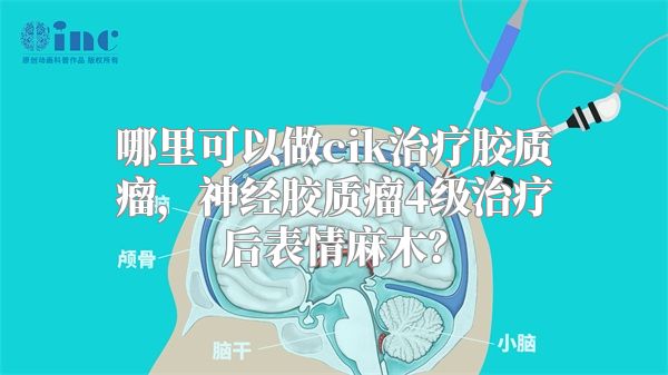 哪里可以做cik治疗胶质瘤，神经胶质瘤4级治疗后表情麻木？