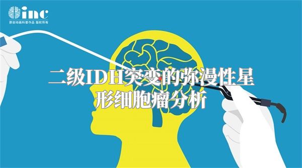 二级IDH突变的弥漫性星形细胞瘤分析