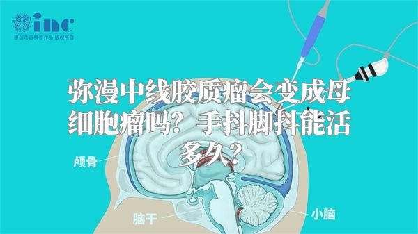 弥漫中线胶质瘤会变成母细胞瘤吗？手抖脚抖能活多久？