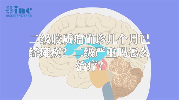 二级胶质瘤确诊几个月已经瘫痪？二级严重吗怎么治疗？