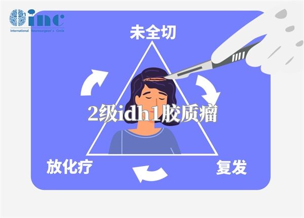 2级idh1胶质瘤