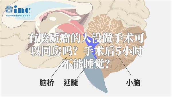 有胶质瘤的人没做手术可以同房吗？手术后5小时不能睡觉？