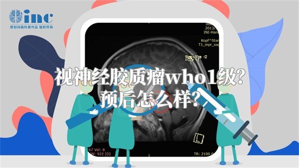 视神经胶质瘤who1级？预后怎么样？