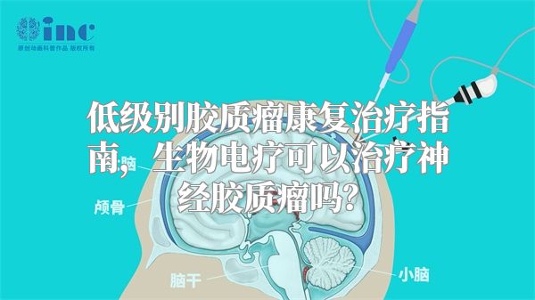 低级别胶质瘤康复治疗指南，生物电疗可以治疗神经胶质瘤吗？