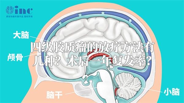 四级胶质瘤的放疗方法有几种？术后一年复发率？