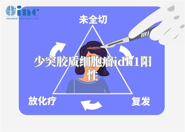 少突胶质细胞瘤idh1阳性