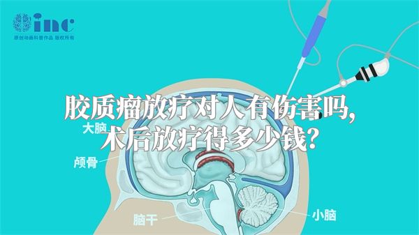 胶质瘤放疗对人有伤害吗，术后放疗得多少钱？