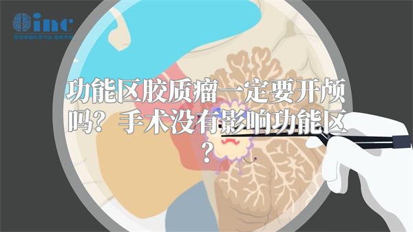 功能区胶质瘤一定要开颅吗？手术没有影响功能区？