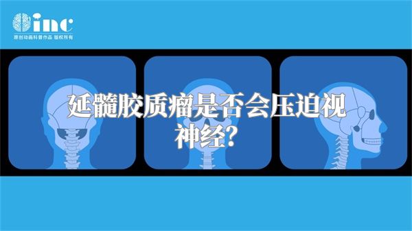 延髓胶质瘤是否会压迫视神经？