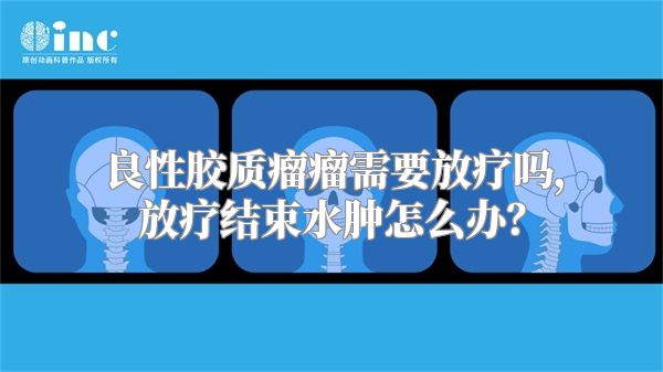 良性胶质瘤瘤需要放疗吗，放疗结束水肿怎么办？