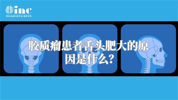 胶质瘤患者舌头肥大的原因是什么？