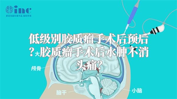 低级别胶质瘤手术后预后？胶质瘤手术后水肿不消头痛？