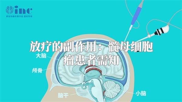 放疗的副作用：髓母细胞瘤患者需知