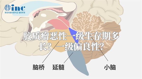 胶质瘤恶性一级生存期多长？一级偏良性？