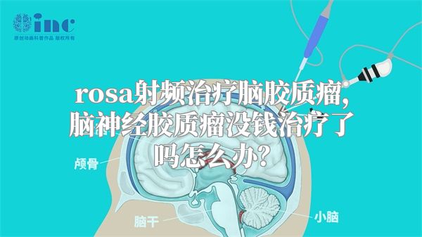 rosa射频治疗脑胶质瘤，脑神经胶质瘤没钱治疗了吗怎么办？