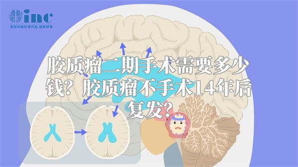 胶质瘤二期手术需要多少钱？胶质瘤不手术14年后复发？