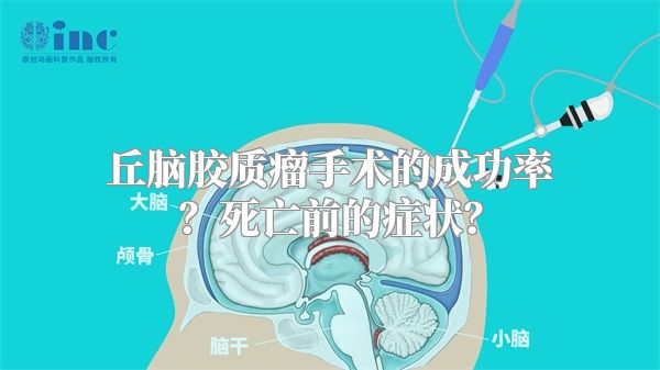 丘脑胶质瘤手术的成功率？死亡前的症状？