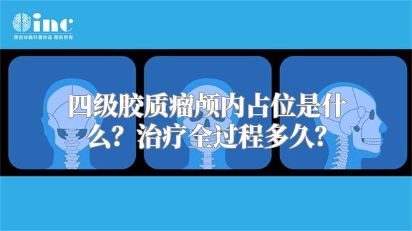 四级胶质瘤颅内占位是什么？治疗全过程多久？