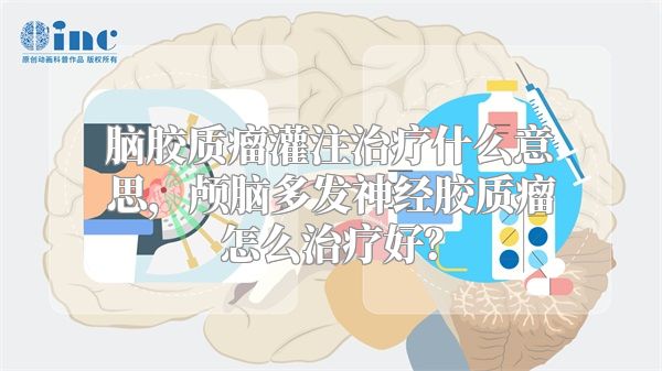 脑胶质瘤灌注治疗什么意思，颅脑多发神经胶质瘤怎么治疗好？