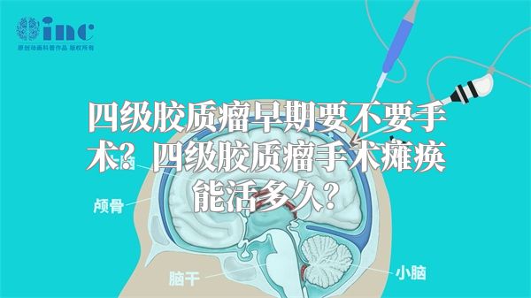 四级胶质瘤早期要不要手术？四级胶质瘤手术瘫痪能活多久？