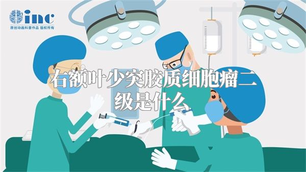 右额叶少突胶质细胞瘤二级是什么