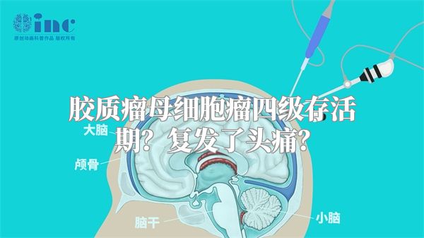 胶质瘤母细胞瘤四级存活期？复发了头痛？