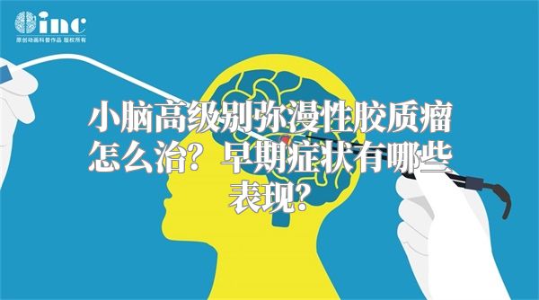 小脑高级别弥漫性胶质瘤怎么治？早期症状有哪些表现？