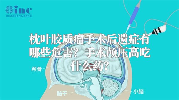 枕叶胶质瘤手术后遗症有哪些危害？手术颅压高吃什么药？