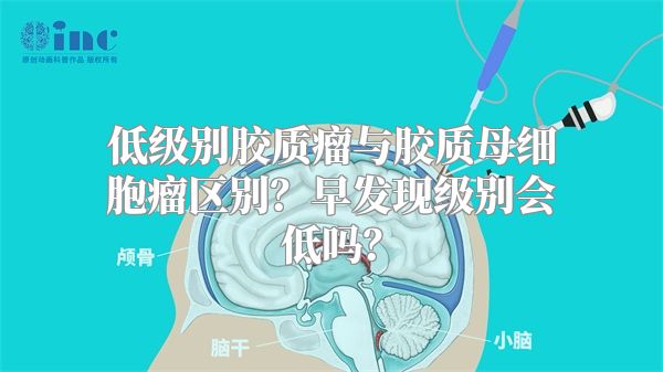 低级别胶质瘤与胶质母细胞瘤区别？早发现级别会低吗？