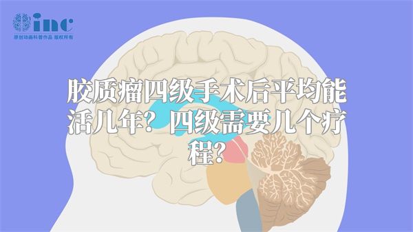 胶质瘤四级手术后平均能活几年？四级需要几个疗程？