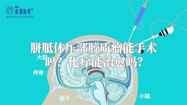 胼胝体压部胶质瘤能手术吗？化疗能治愈吗？