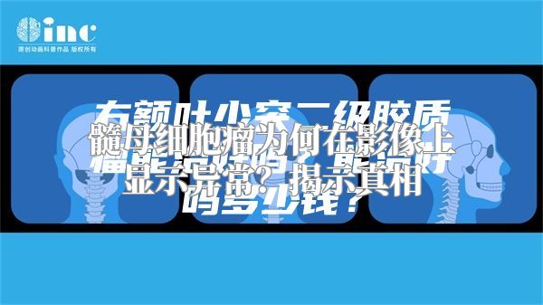 髓母细胞瘤为何在影像上显示异常？揭示真相