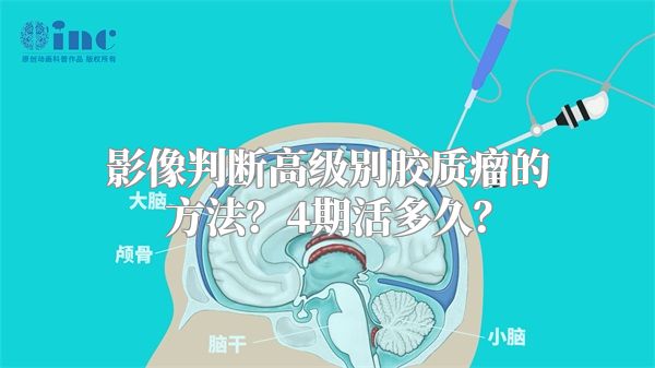 影像判断高级别胶质瘤的方法？4期活多久？