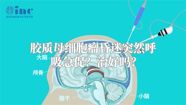 胶质母细胞瘤昏迷突然呼吸急促？治好吗？