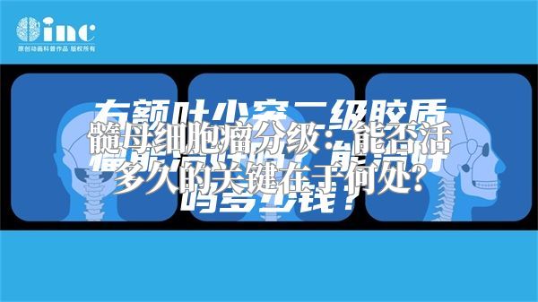 髓母细胞瘤分级：能否活多久的关键在于何处？