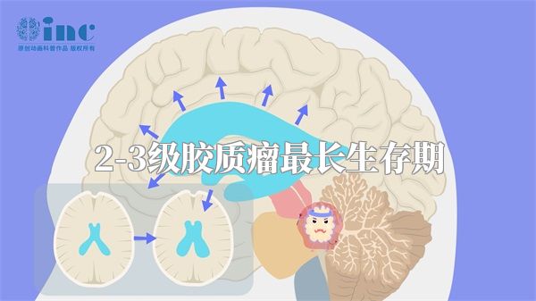 2-3级胶质瘤最长生存期