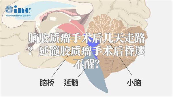 脑胶质瘤手术后几天走路？延髓胶质瘤手术后昏迷不醒？