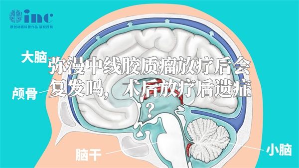 弥漫中线胶质瘤放疗后会复发吗，术后放疗后遗症？