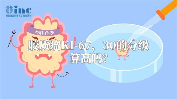 胶质瘤KI-67，30的分级算高吗？