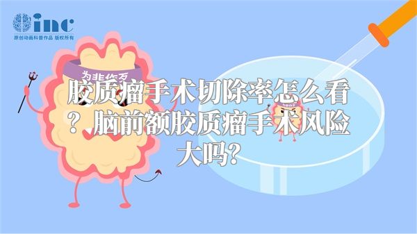 胶质瘤手术切除率怎么看？脑前额胶质瘤手术风险大吗？