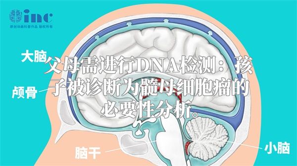 父母需进行DNA检测：孩子被诊断为髓母细胞瘤的必要性分析。