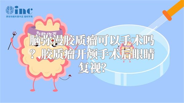 脑弥漫胶质瘤可以手术吗？胶质瘤开颅手术后眼睛复视？