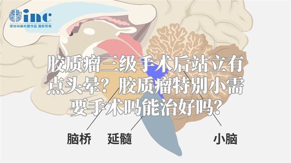 胶质瘤三级手术后站立有点头晕？胶质瘤特别小需要手术吗能治好吗？