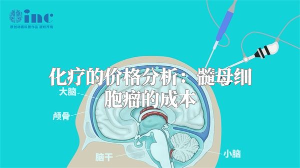 化疗的价格分析：髓母细胞瘤的成本