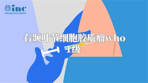 右颞叶节细胞胶质瘤who1级  