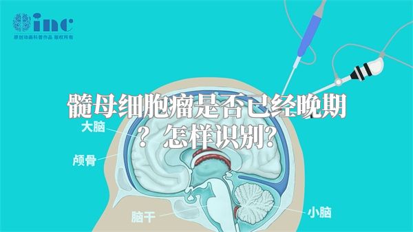 髓母细胞瘤是否已经晚期？怎样识别？